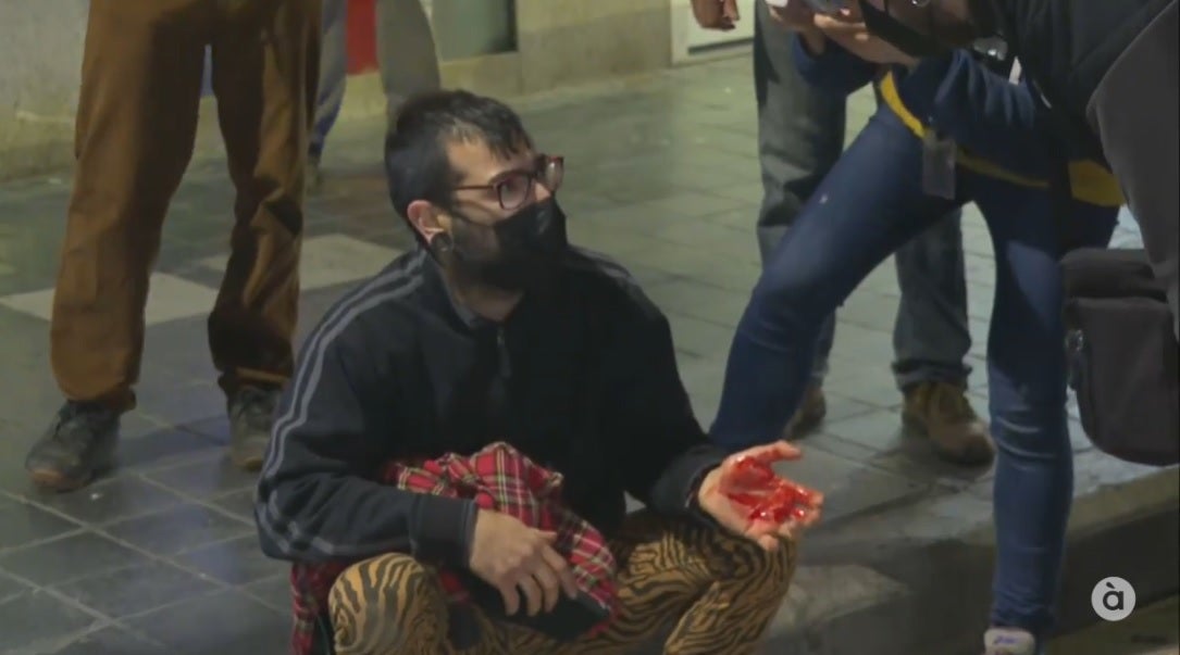 Un dels manifestants ferit per un cop de porra al cap