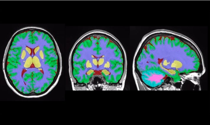 La UPV i el CNRS de França creen una nova eina en línia per a l'estudi del cervell