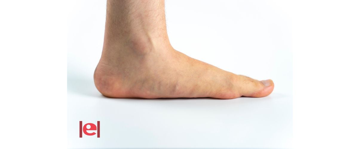 Peus Plans i les seues solucions