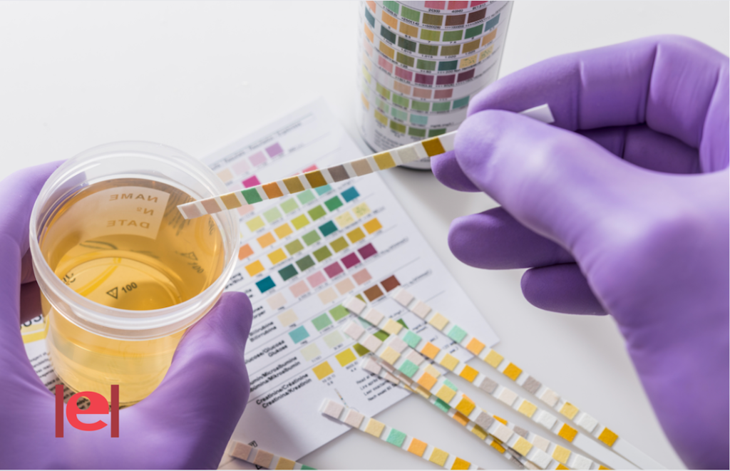 Per què són més freqüents les infeccions d’orina a l’estiu ?