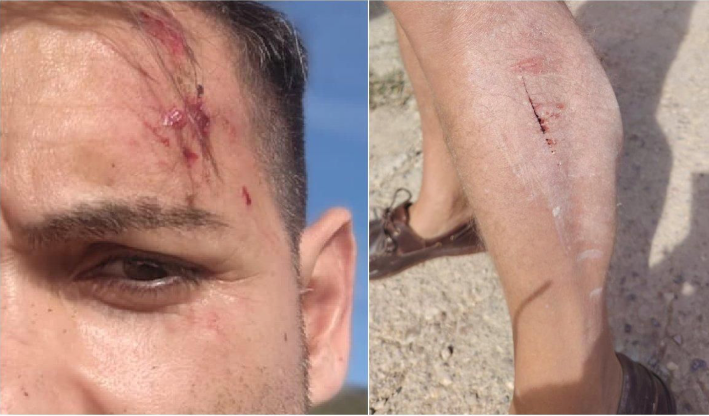 Ferides patides pels periodistes en l'agressió a Alcalà de Xivert | À Punt
