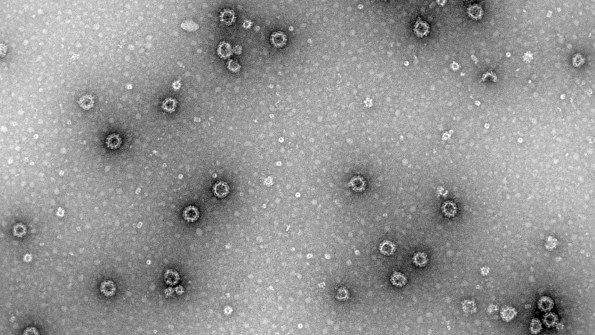 Partícules de norovirus capturades per microscopia electrònica de transmissió. La barra indica 100 nm. UV