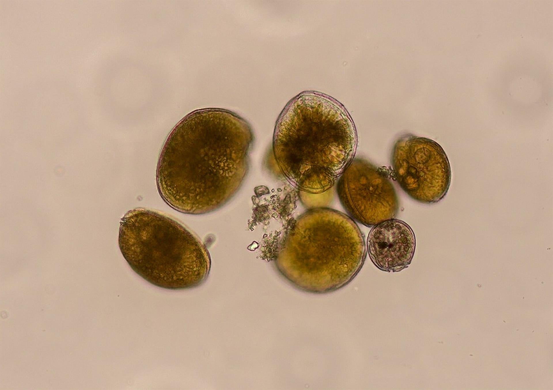 Imatge de 'Gambierdiscus australs' en microscopi òptic invertit | UA