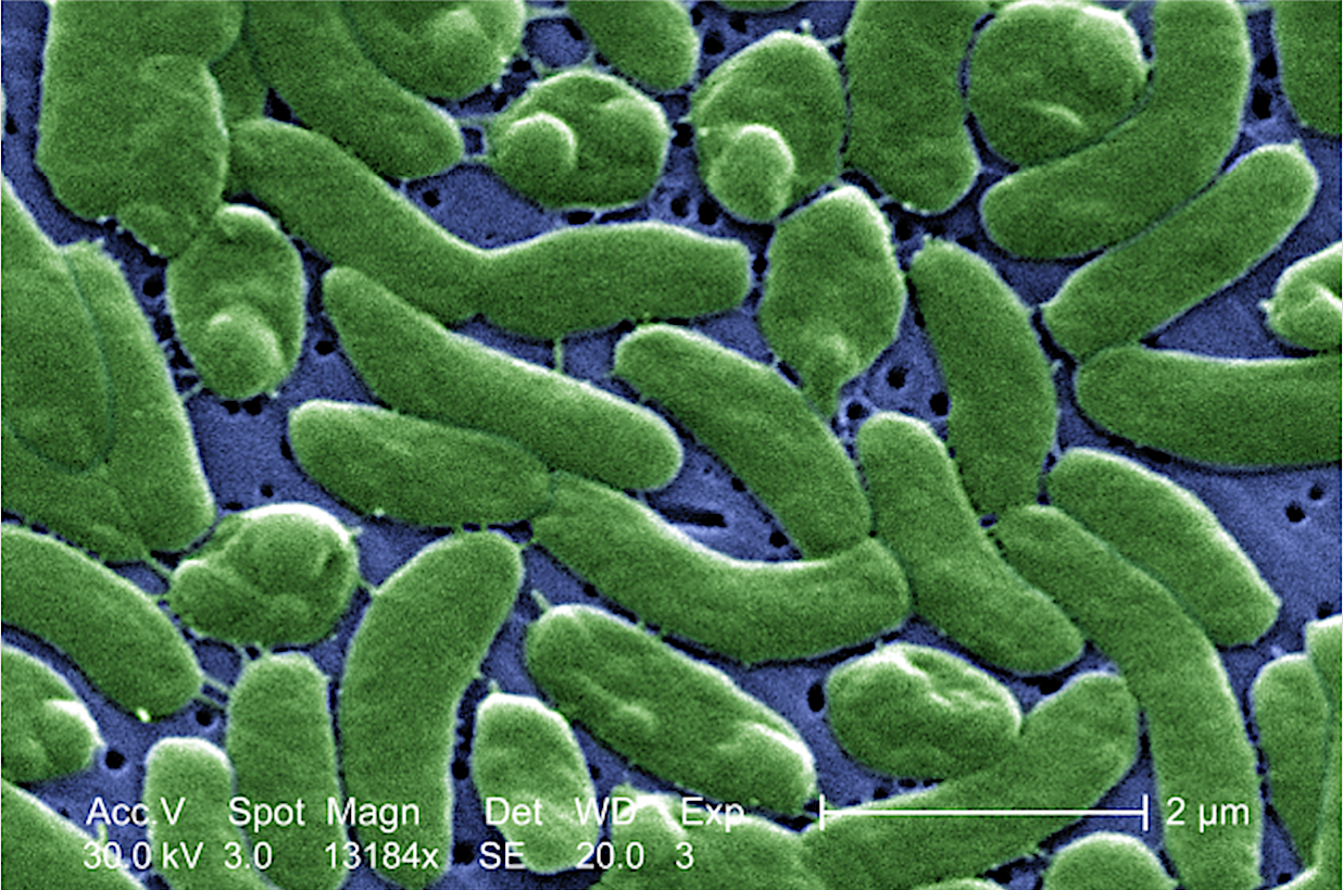 Bacteri carnívor marí 'Vibrio Vulnificus' | Wikimedia Commons